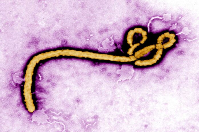ebola virus infection