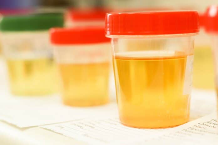 urine therapy Shivambu Kalpa